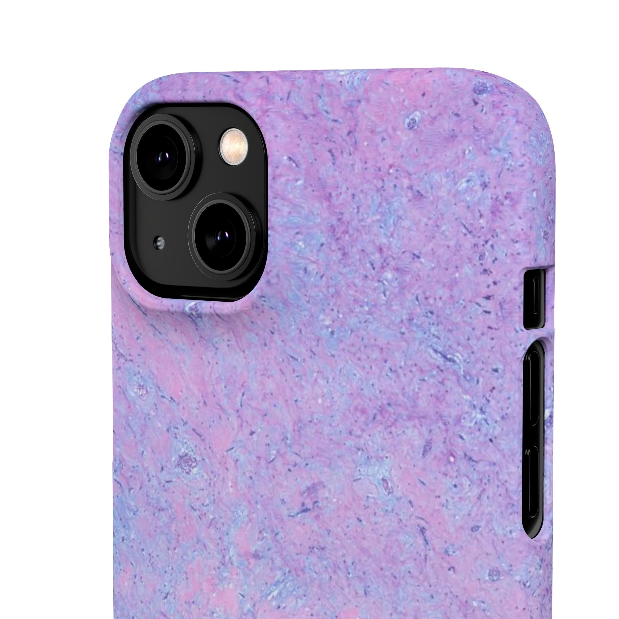 Slim Case Arterielles Myxom