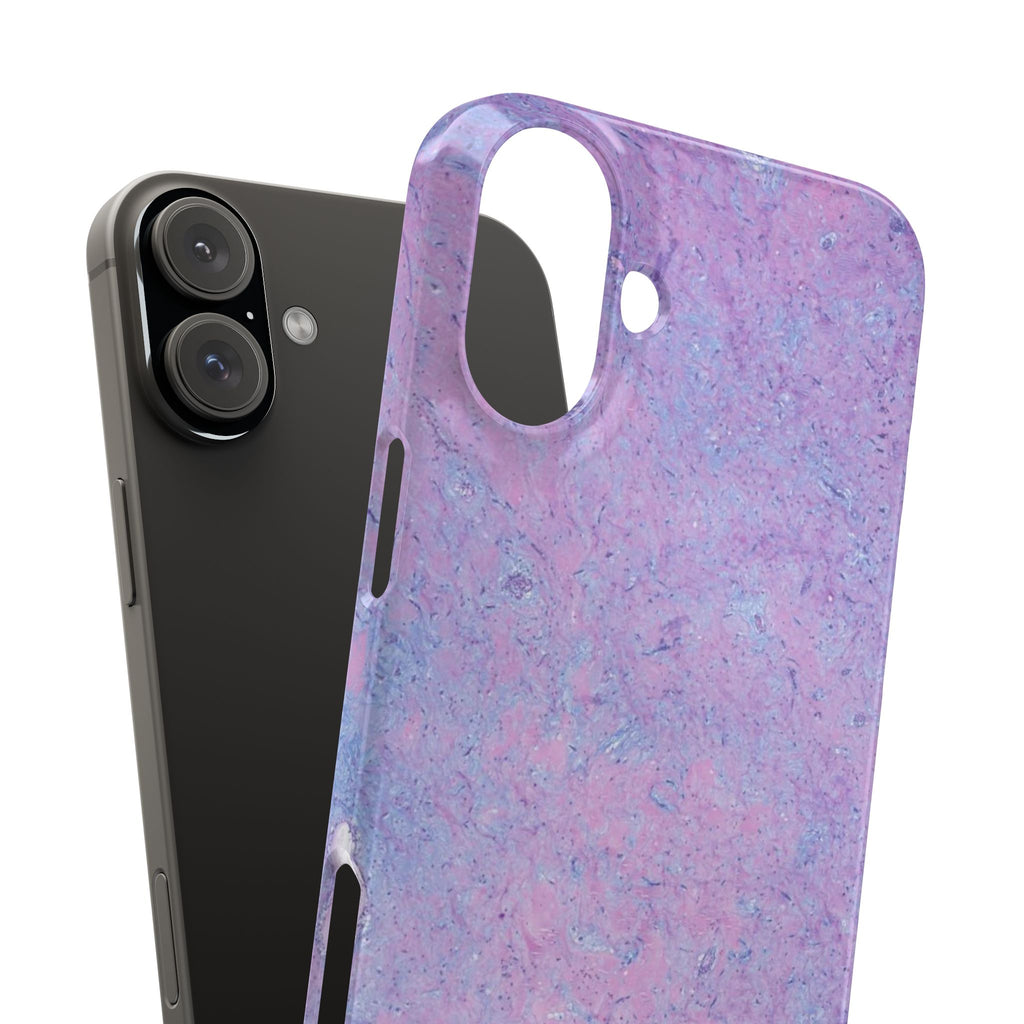 Slim Case Arterielles Myxom