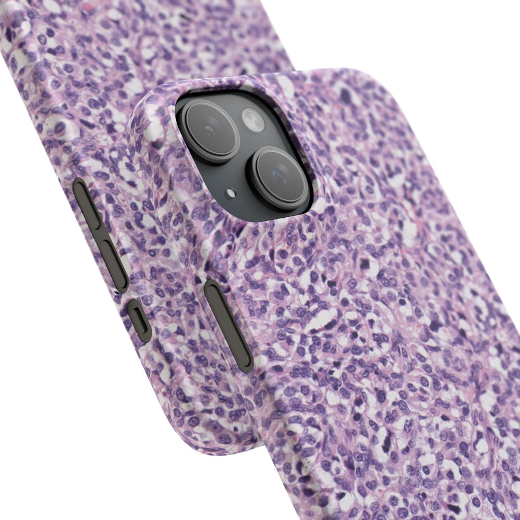 Slim Case Paraganglion
