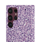 Slim Case Paraganglion