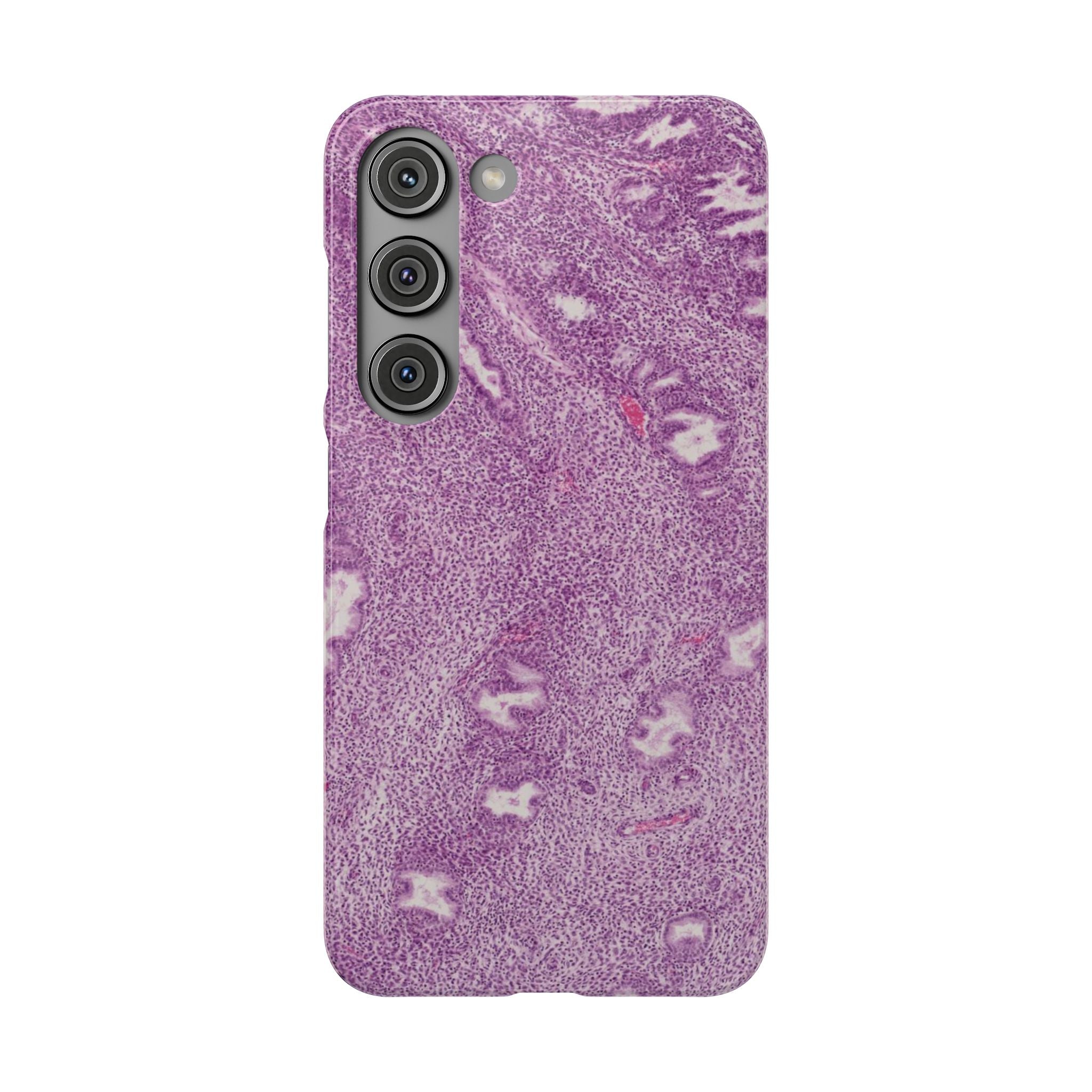 Slim Case Endometrium