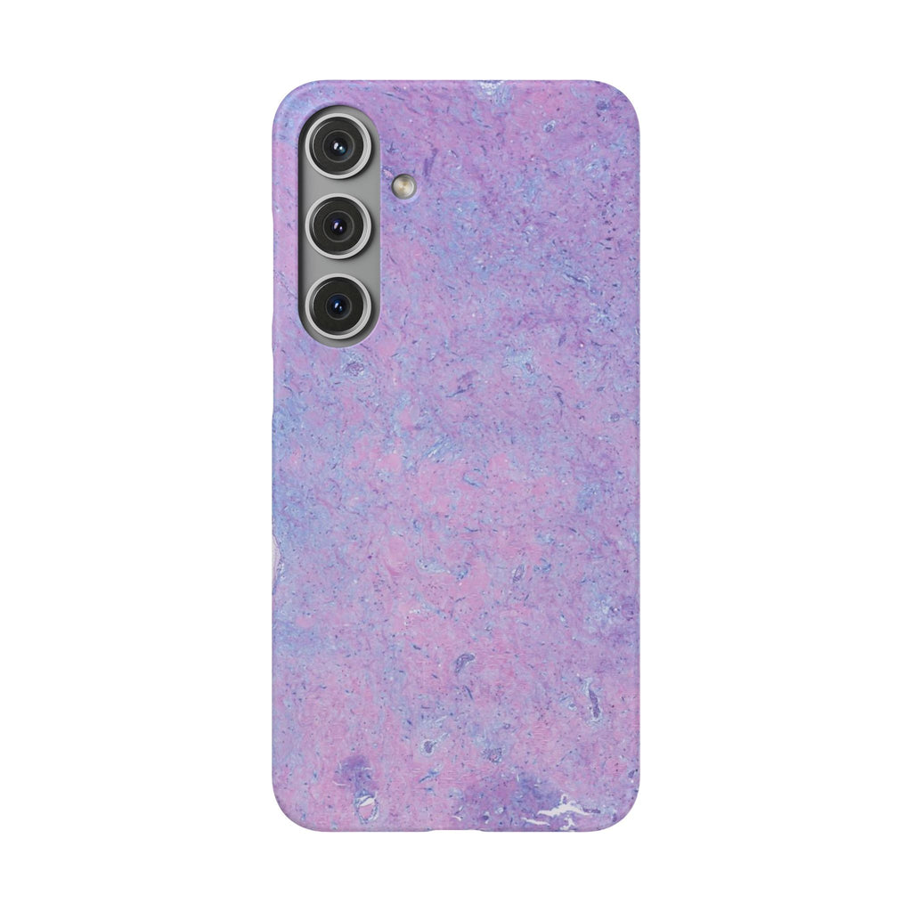 Slim Case Arterielles Myxom