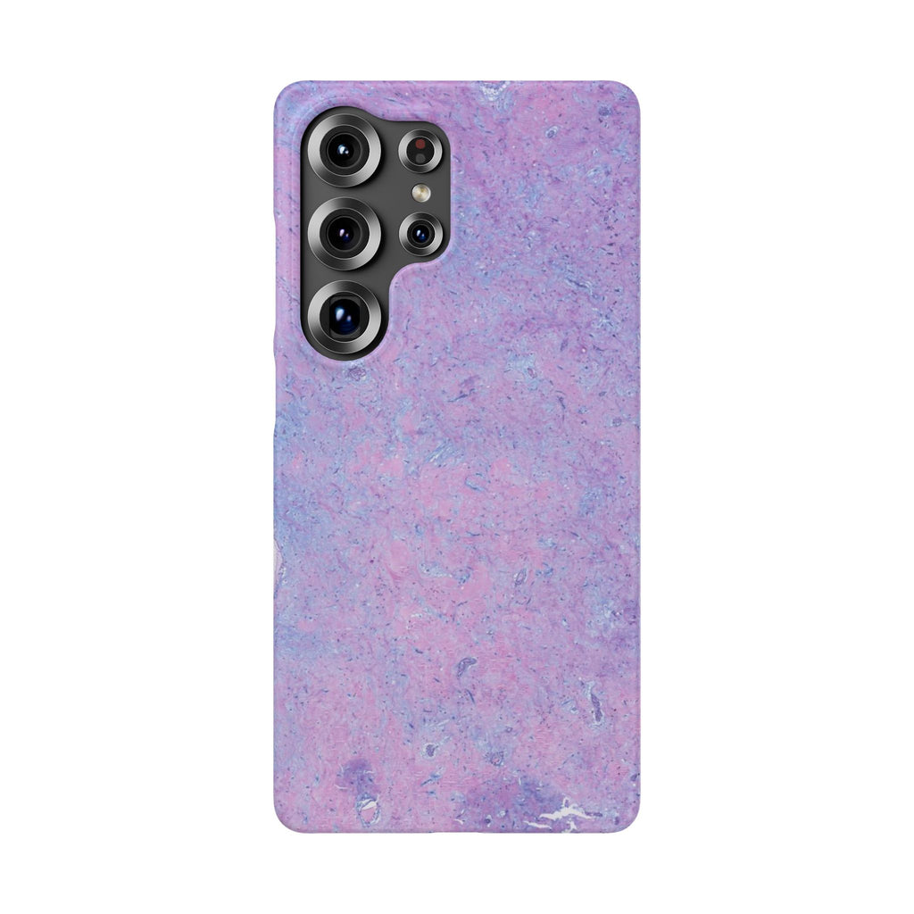 Slim Case Arterielles Myxom
