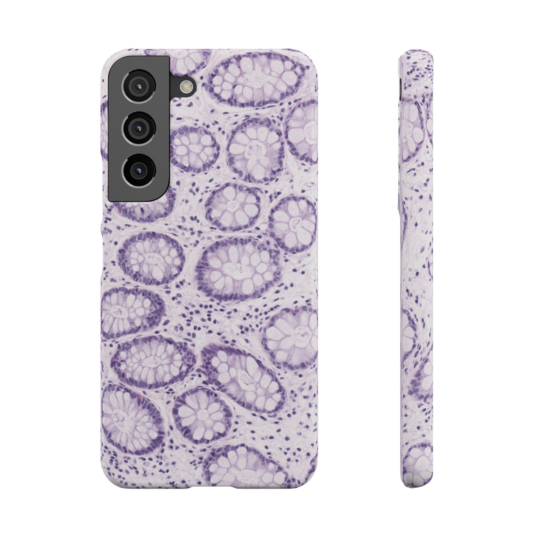 Slim Case Kolon