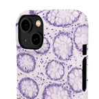 Slim Case Kolon