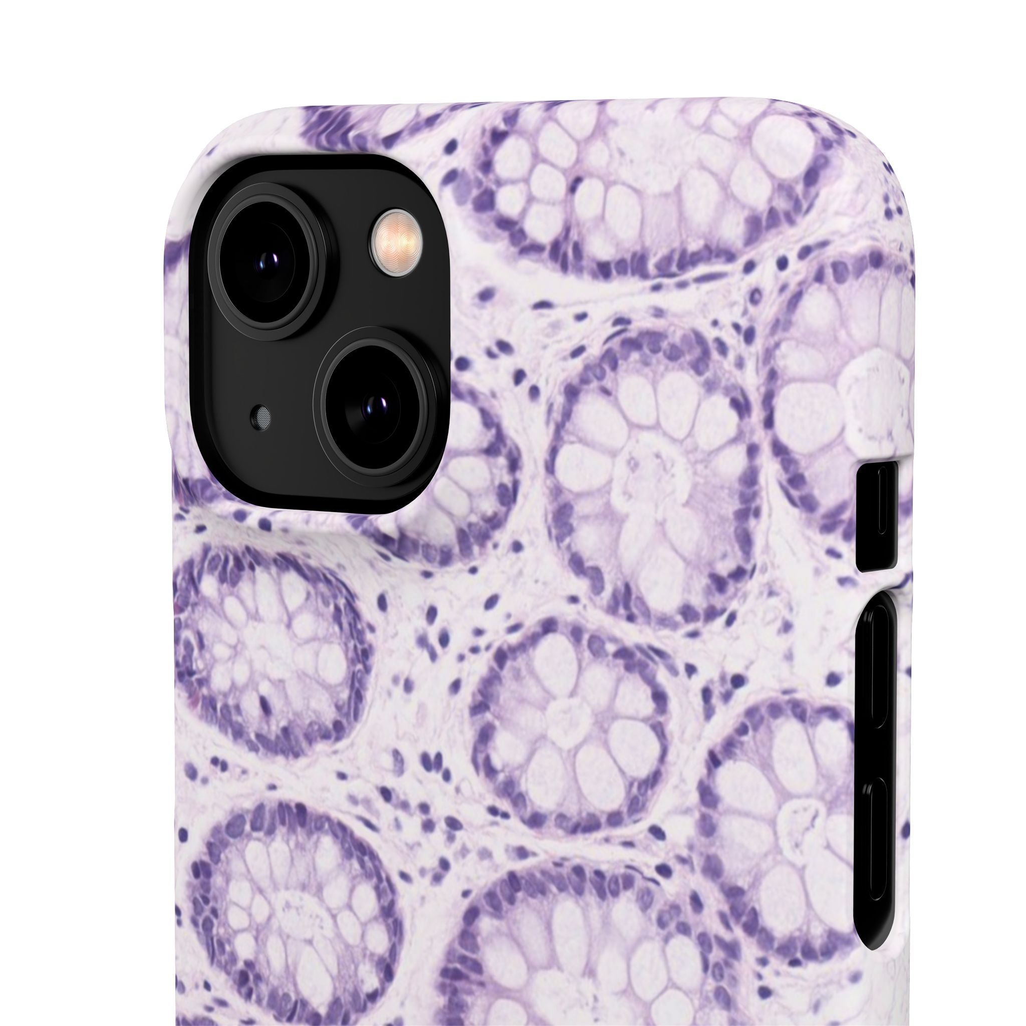 Slim Case Kolon