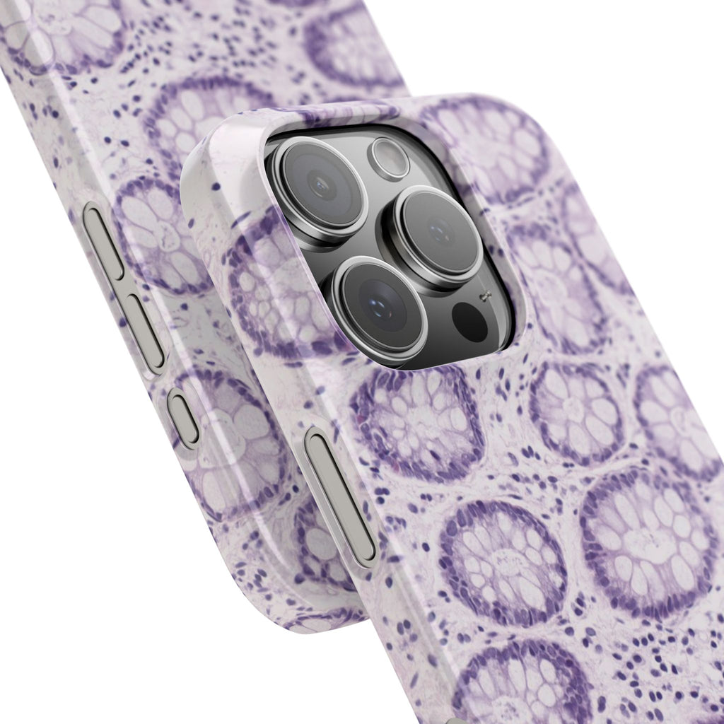 Slim Case Kolon