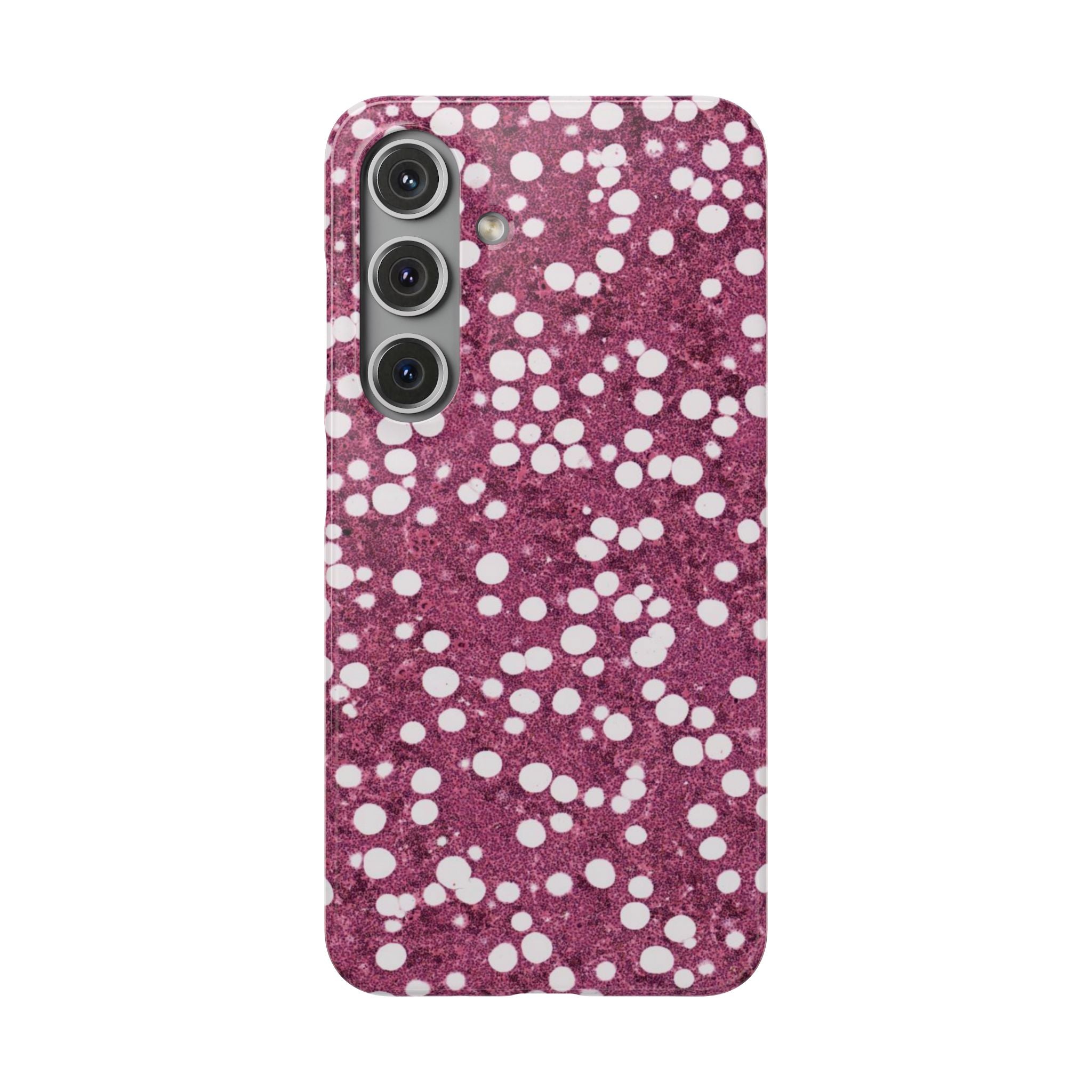 Slim Case Myelolipom