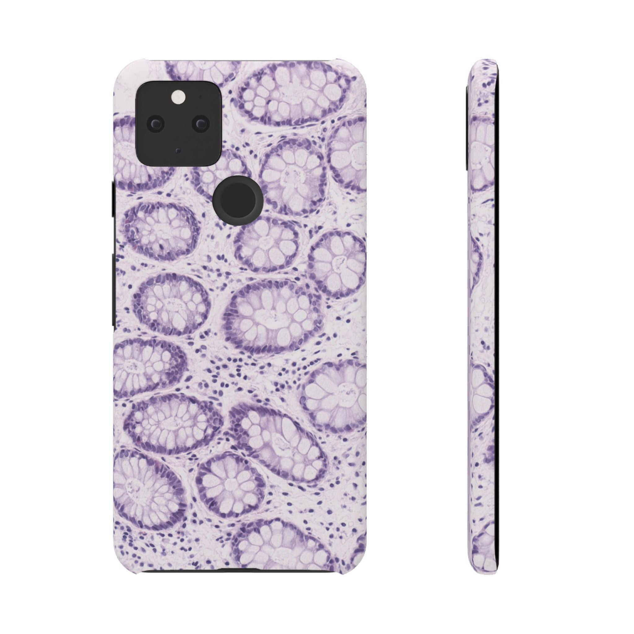 Slim Case Kolon