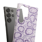 Slim Case Kolon
