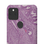 Slim Case Endometrium