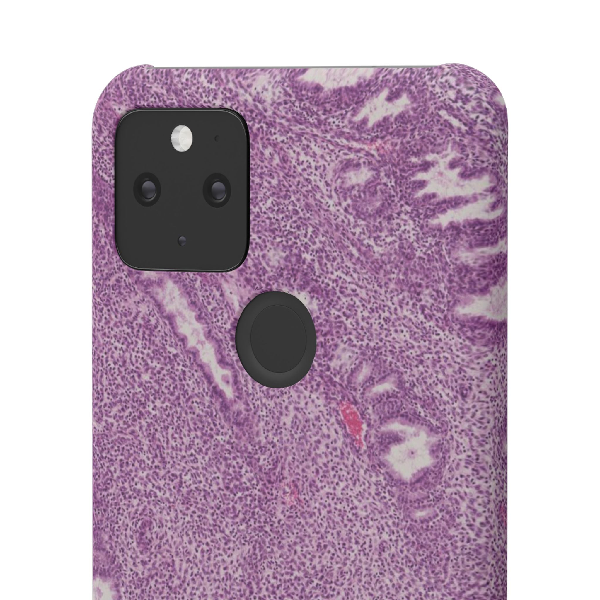 Slim Case Endometrium