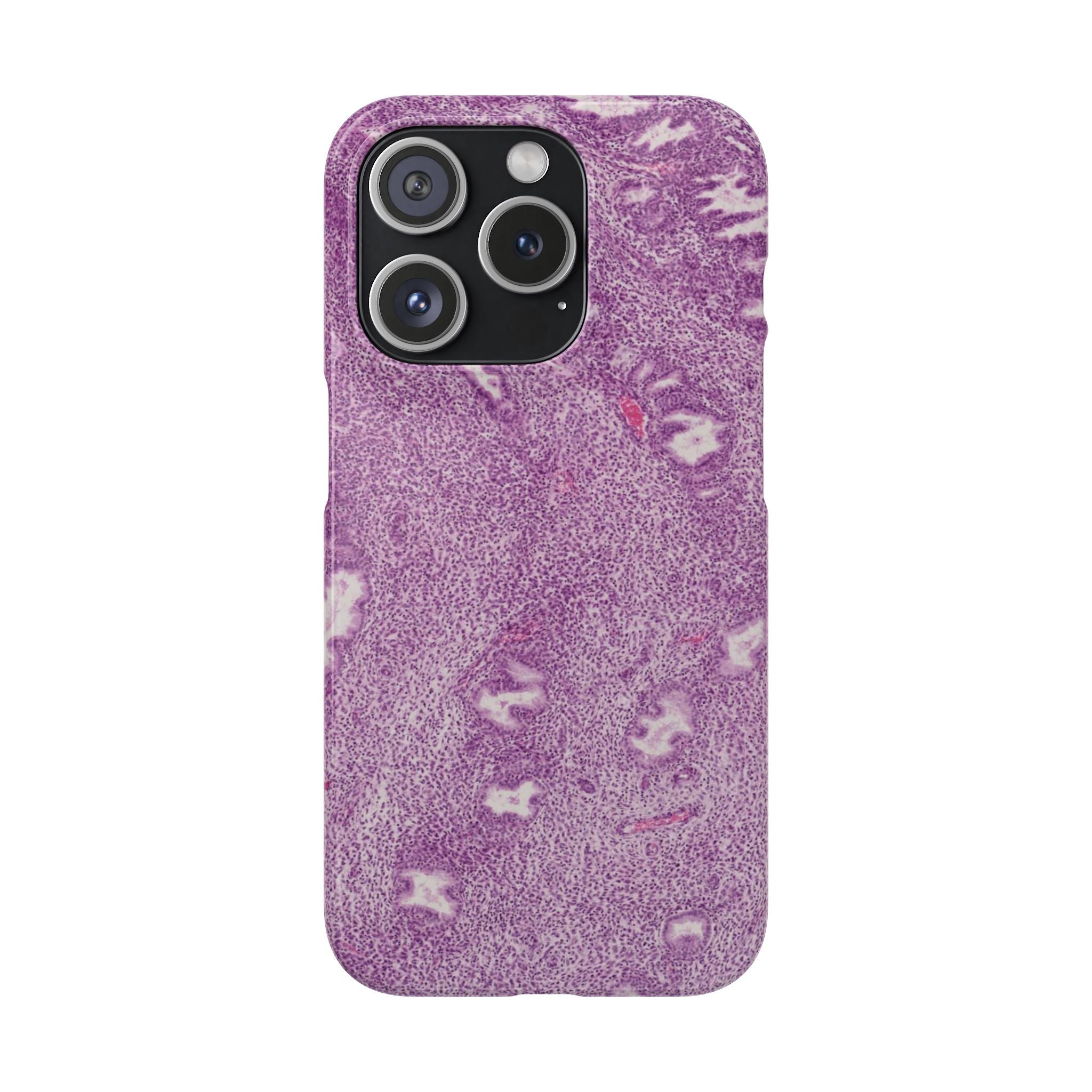 Slim Case Endometrium