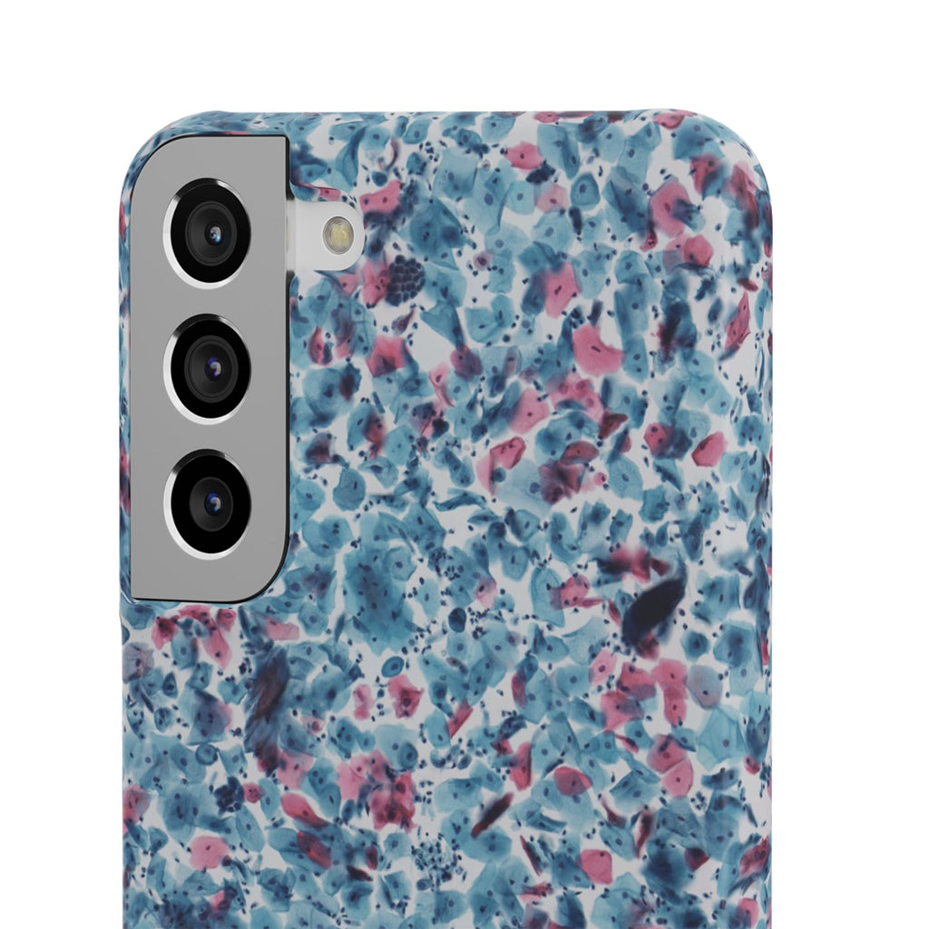 Slim Case PAP