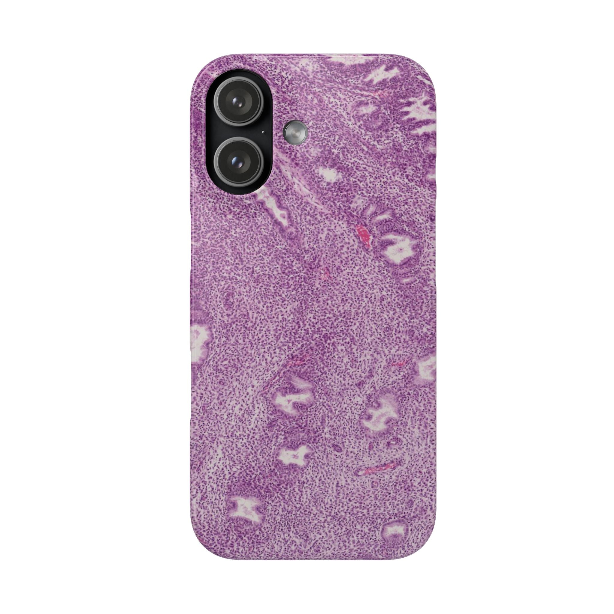 Slim Case Endometrium
