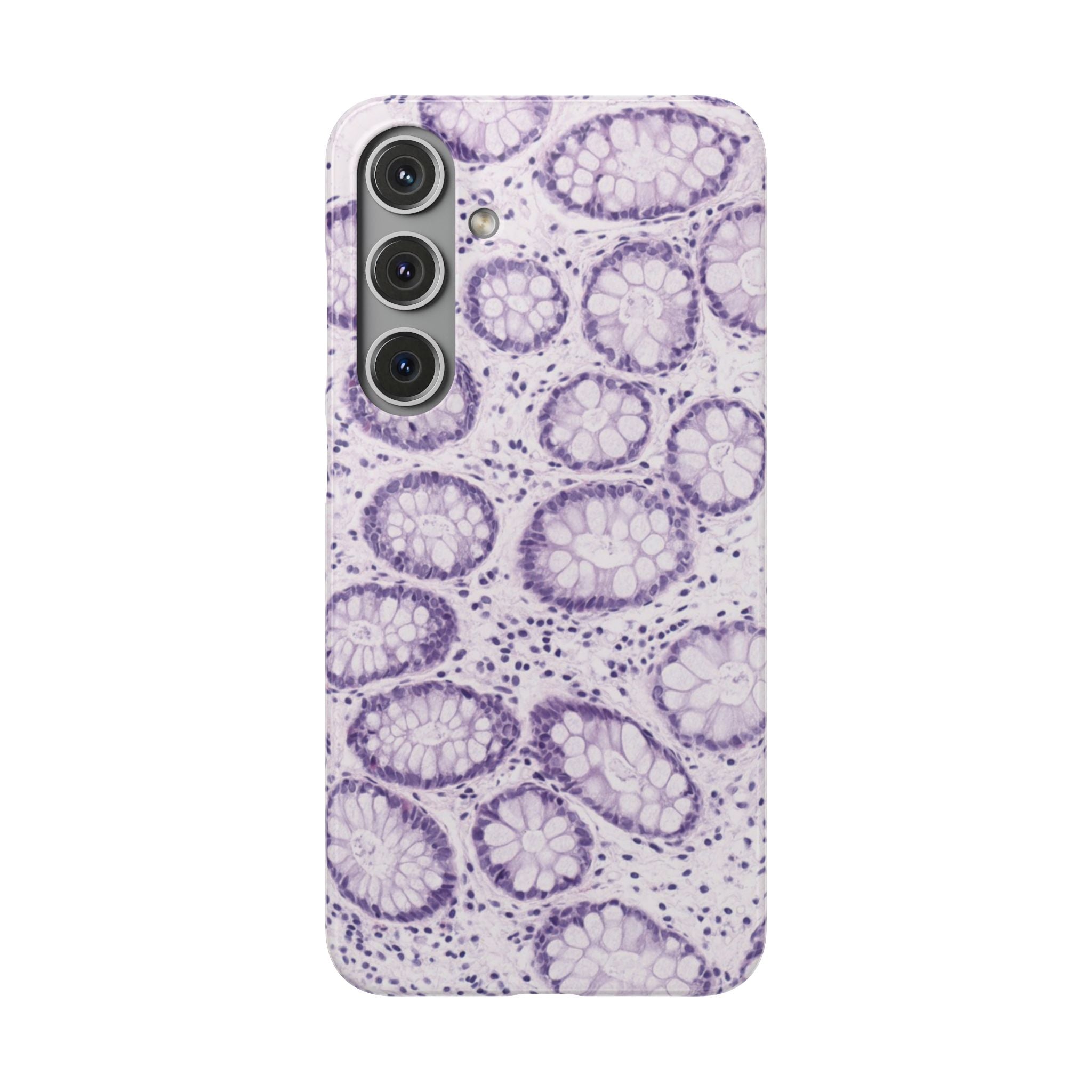 Slim Case Kolon