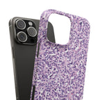 Slim Case Paraganglion