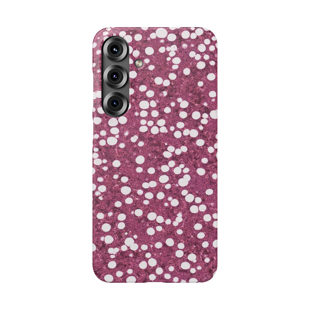 Slim Case Myelolipom