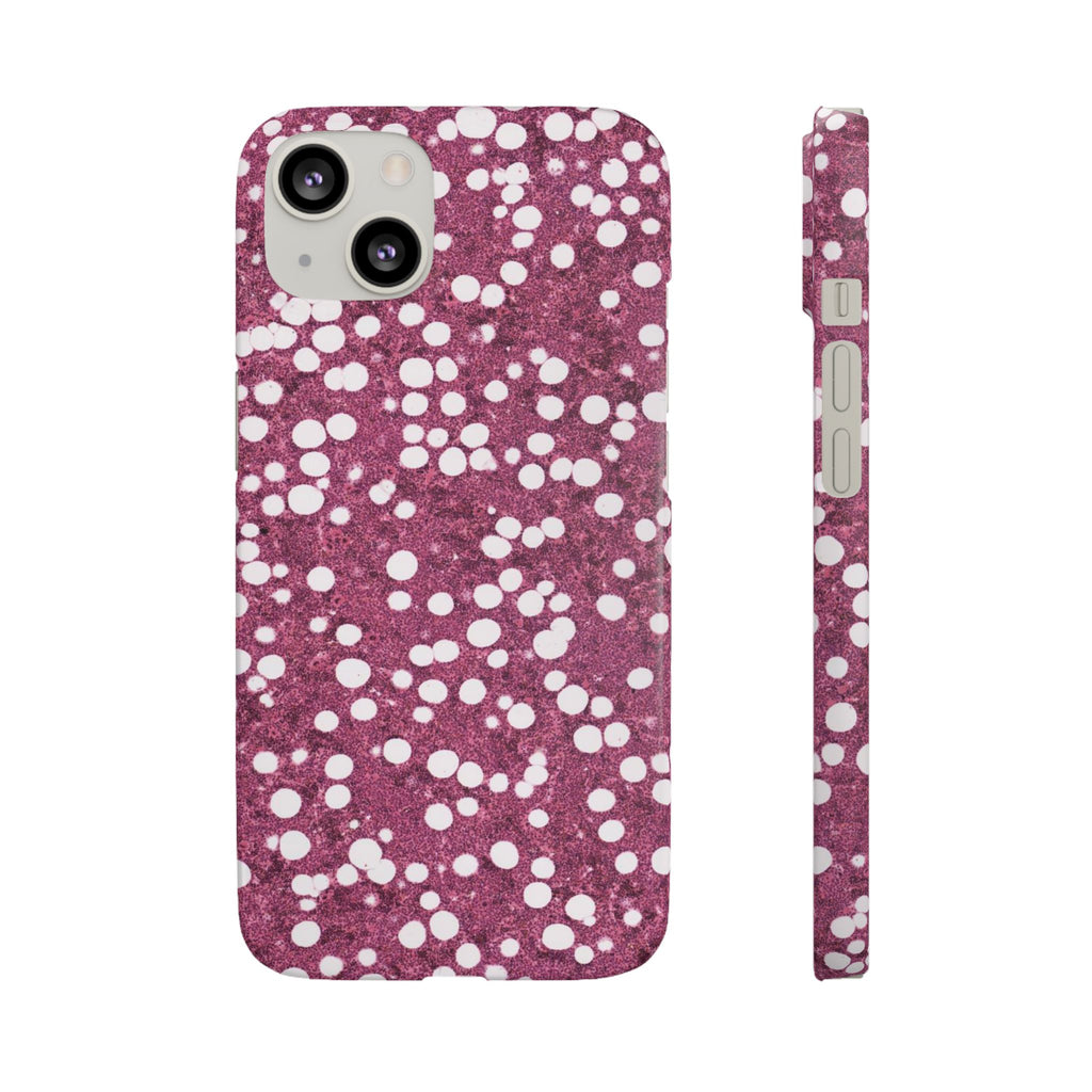 Slim Case Myelolipom
