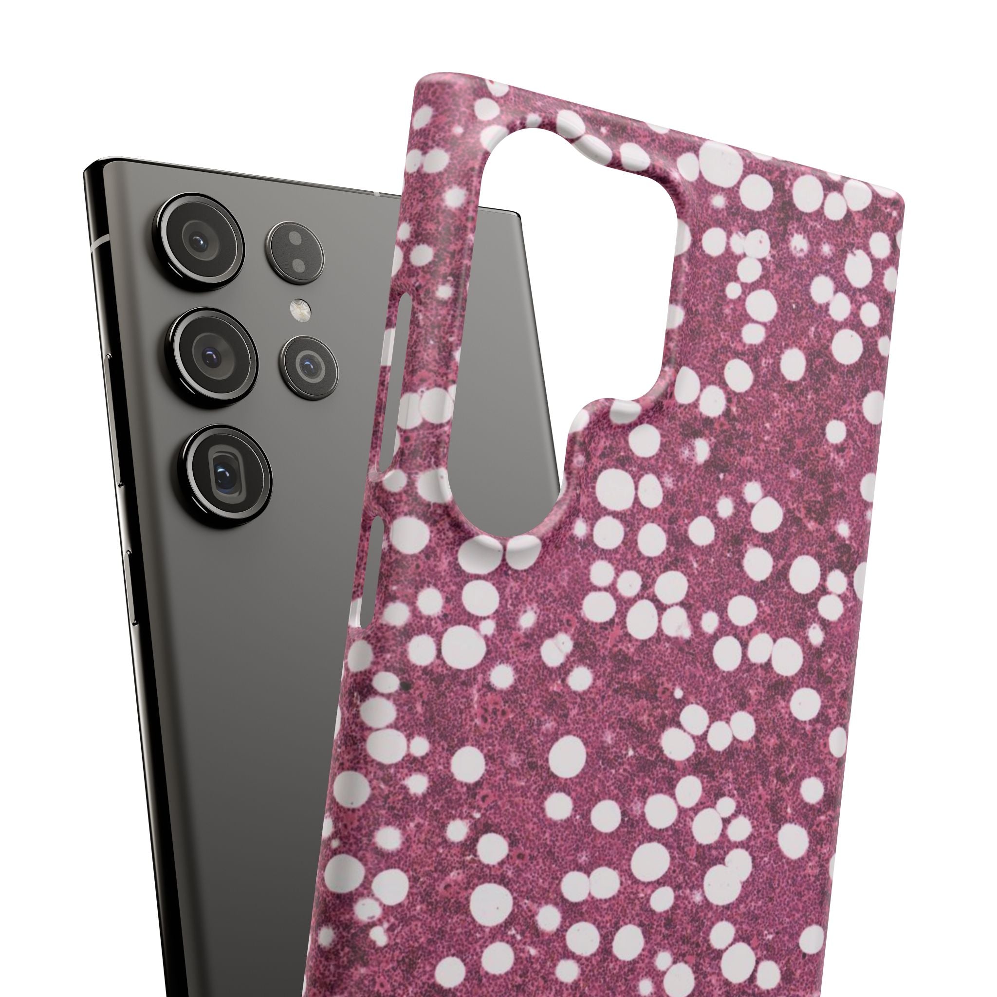 Slim Case Myelolipom