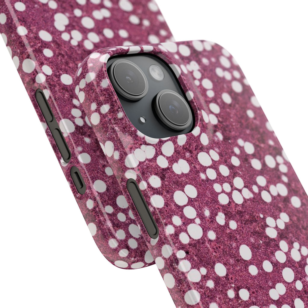 Slim Case Myelolipom