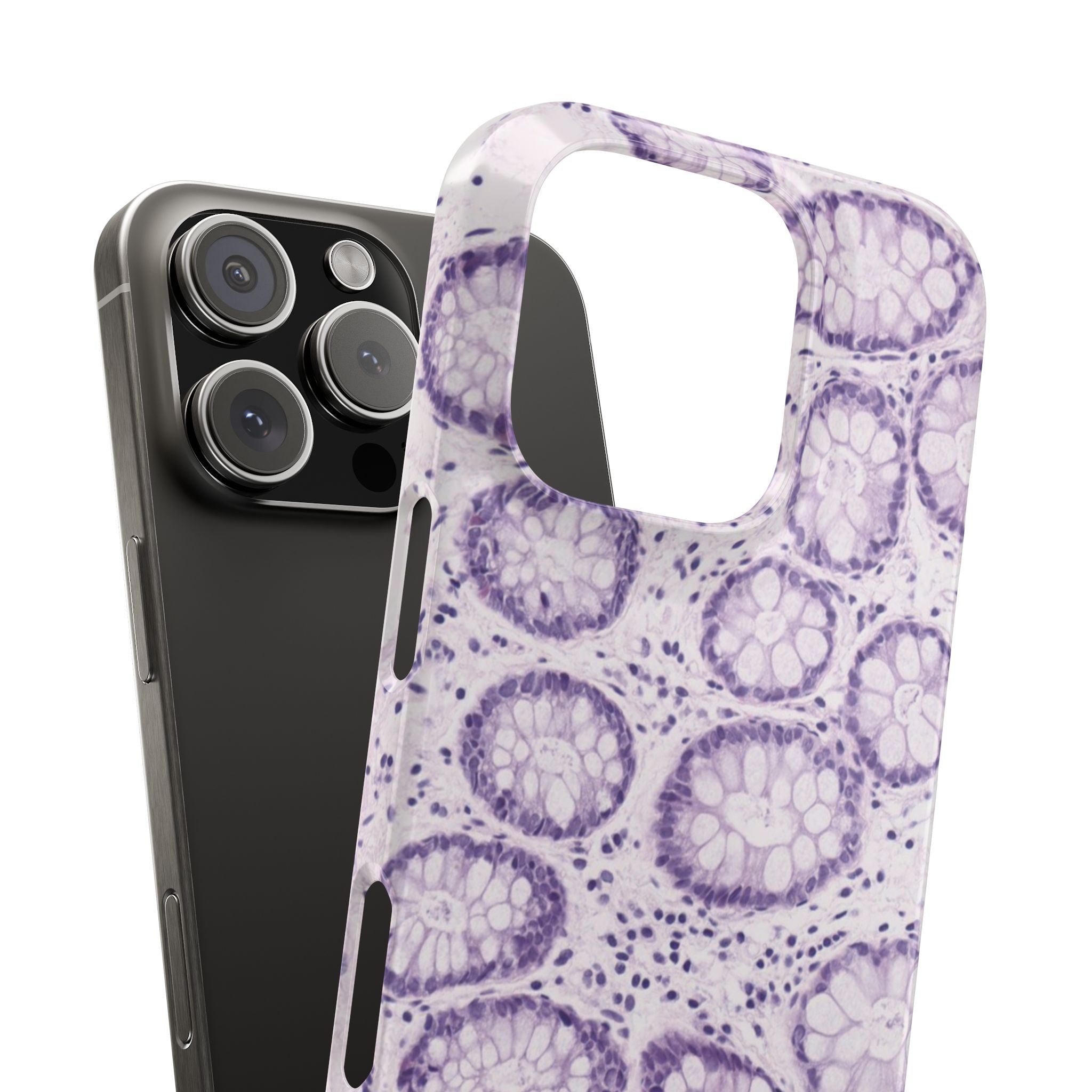 Slim Case Kolon