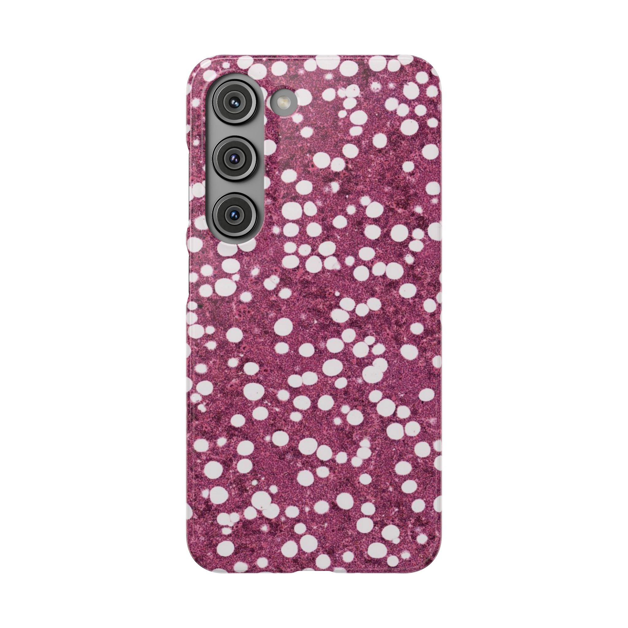 Slim Case Myelolipom