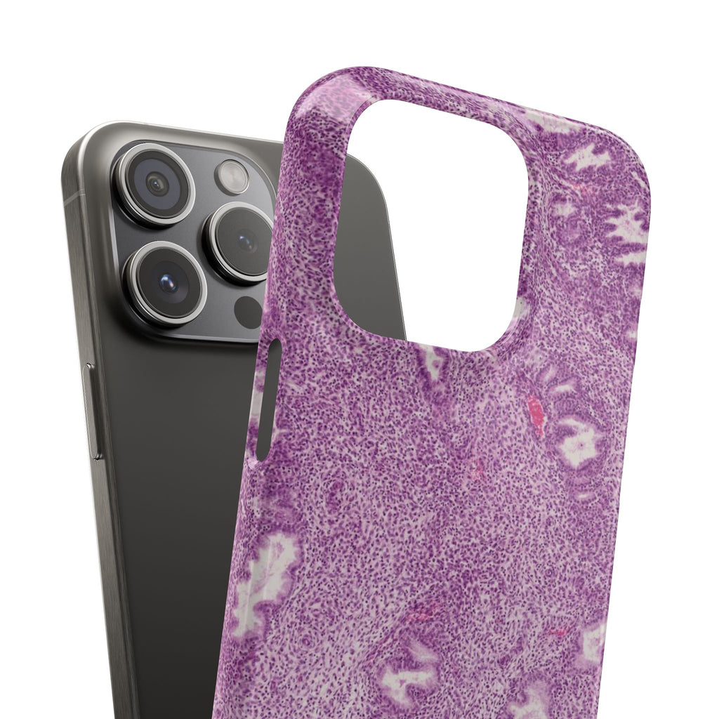 Slim Case Endometrium
