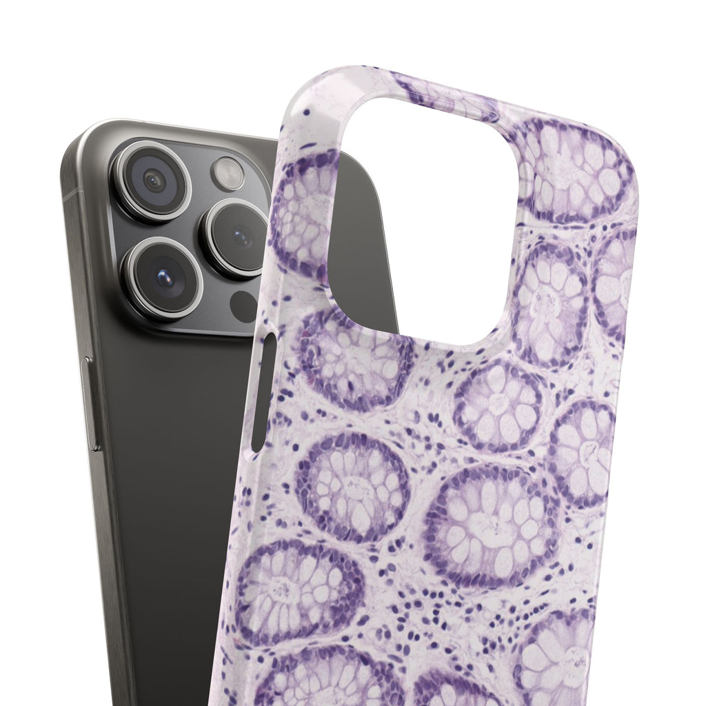 Slim Case Kolon