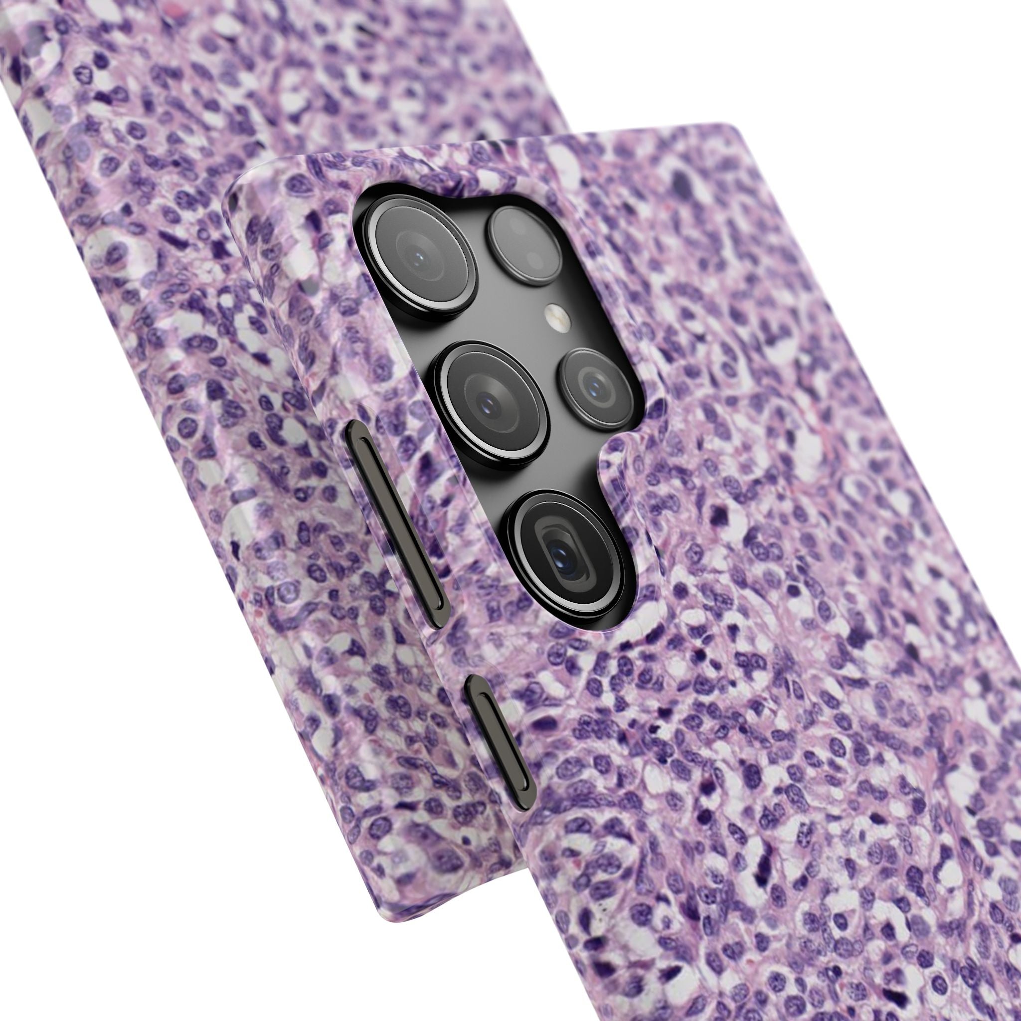 Slim Case Paraganglion