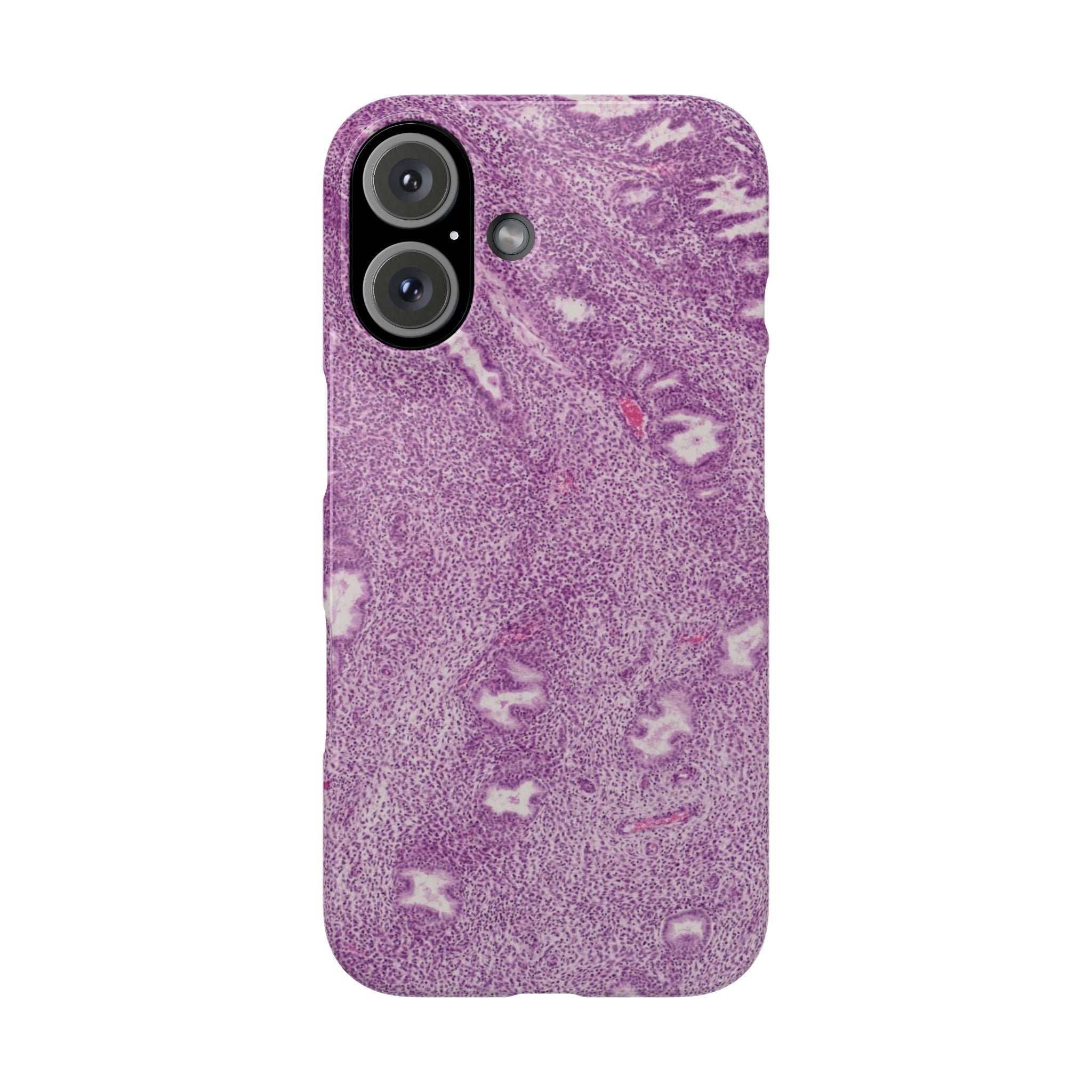 Slim Case Endometrium