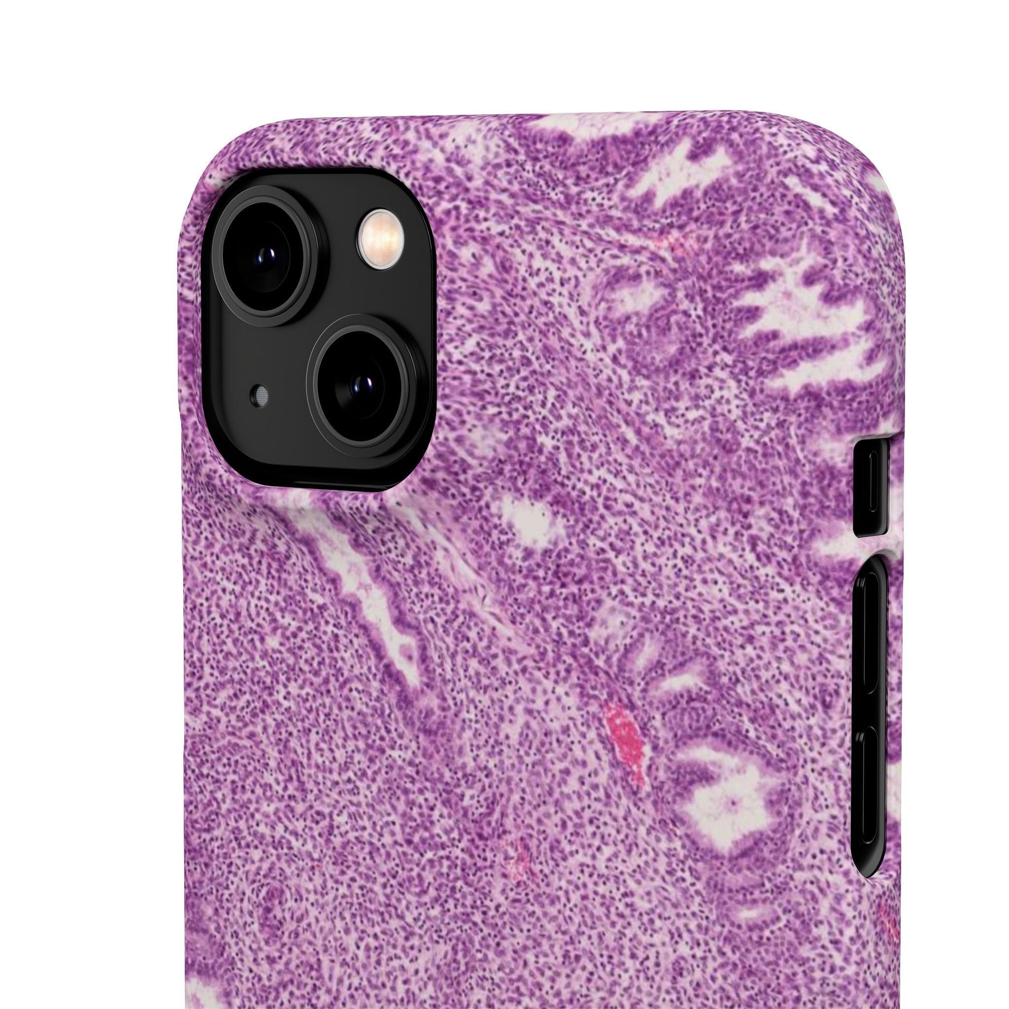 Slim Case Endometrium