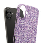Slim Case Paraganglion