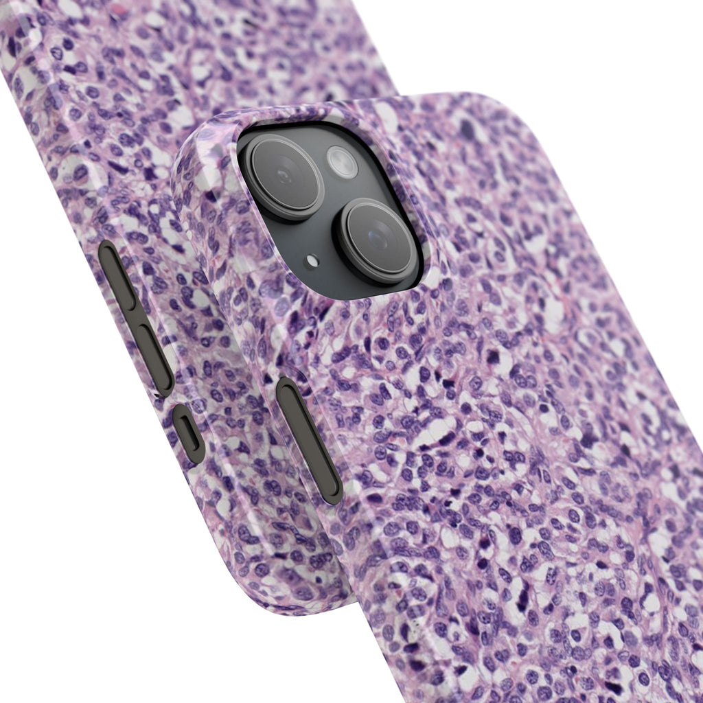 Slim Case Paraganglion