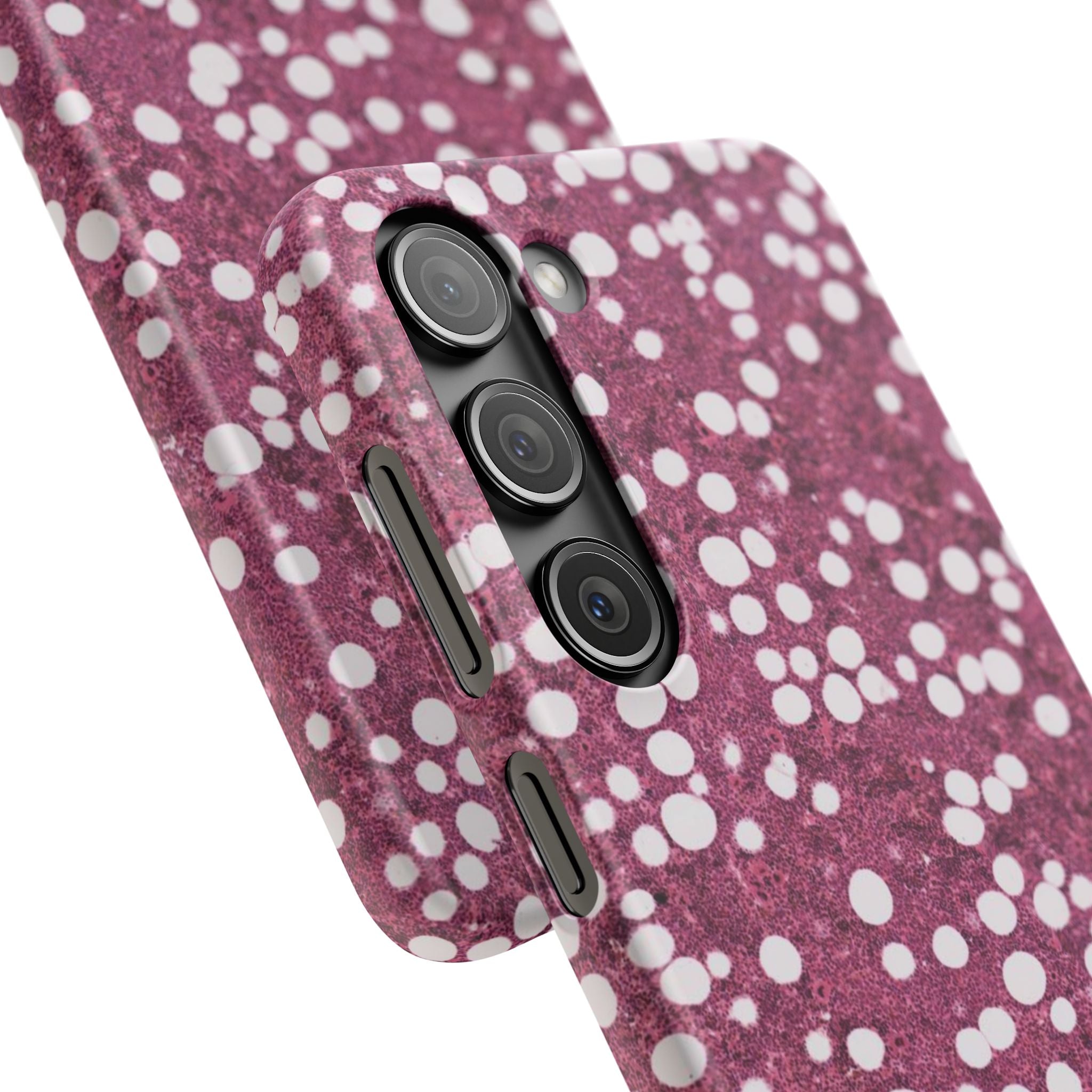 Slim Case Myelolipom