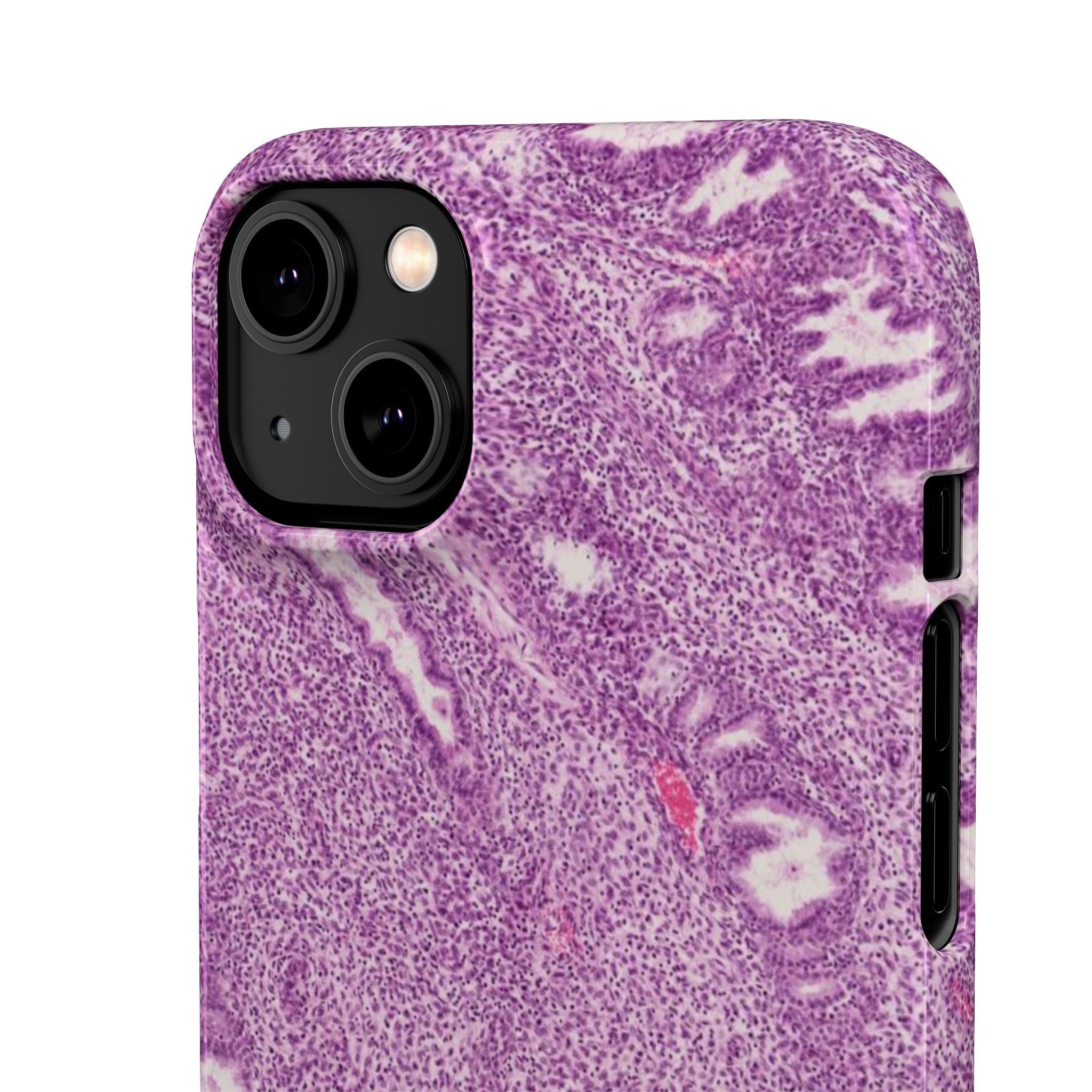 Slim Case Endometrium