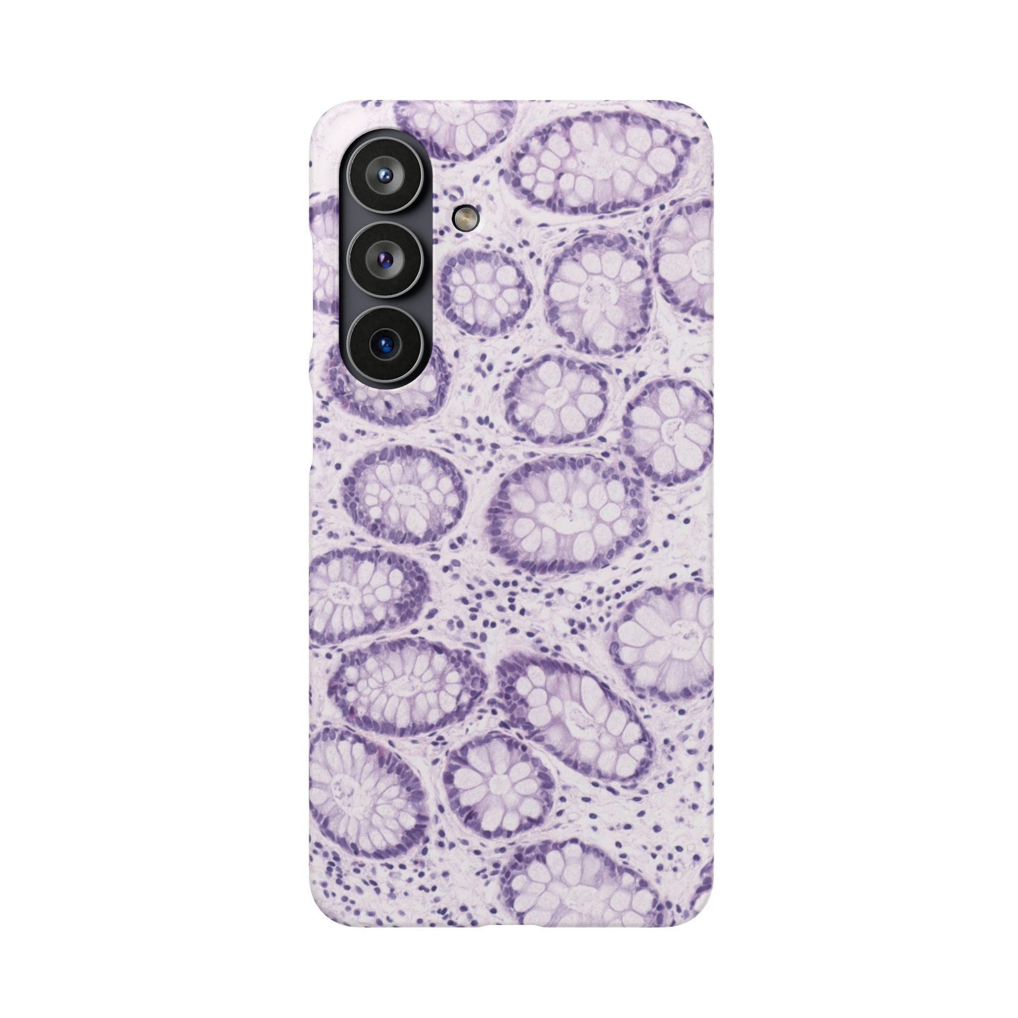 Slim Case Kolon