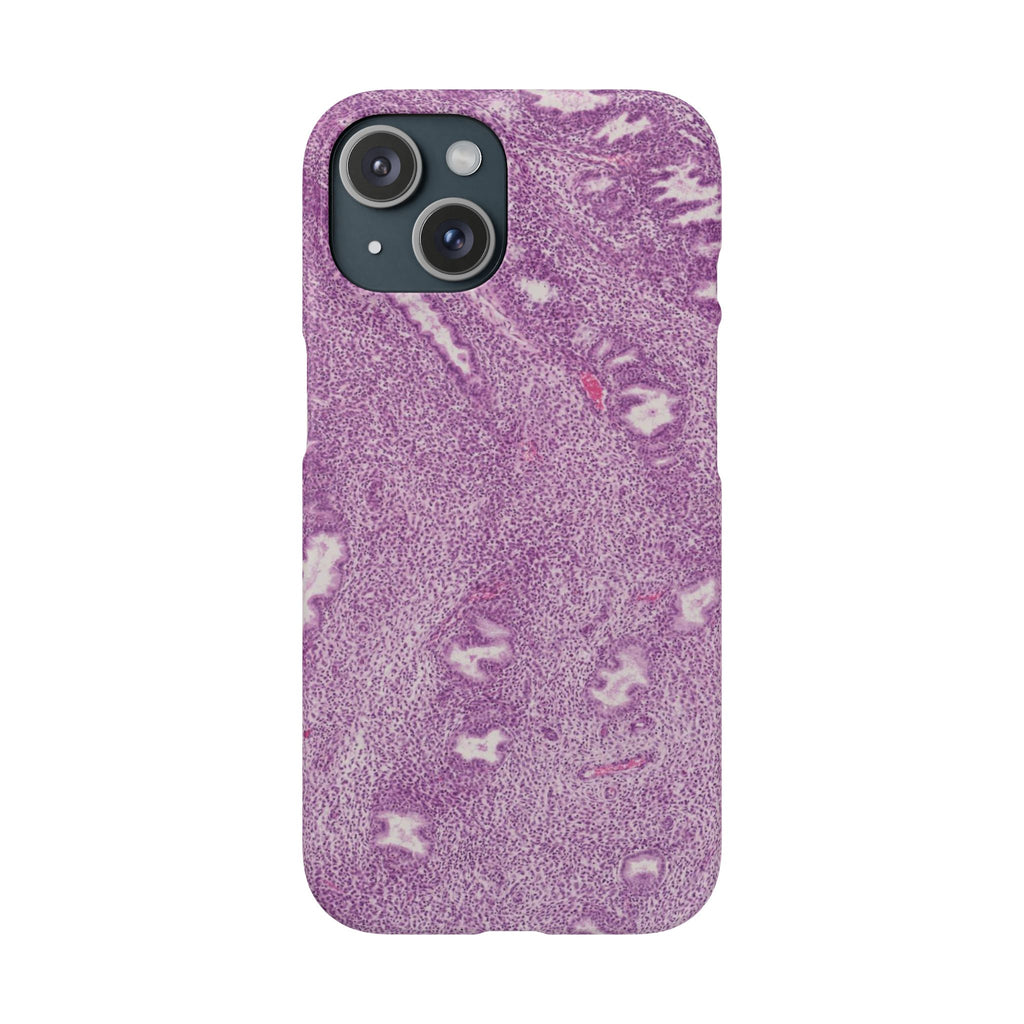 Slim Case Endometrium