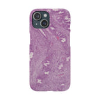 Slim Case Endometrium