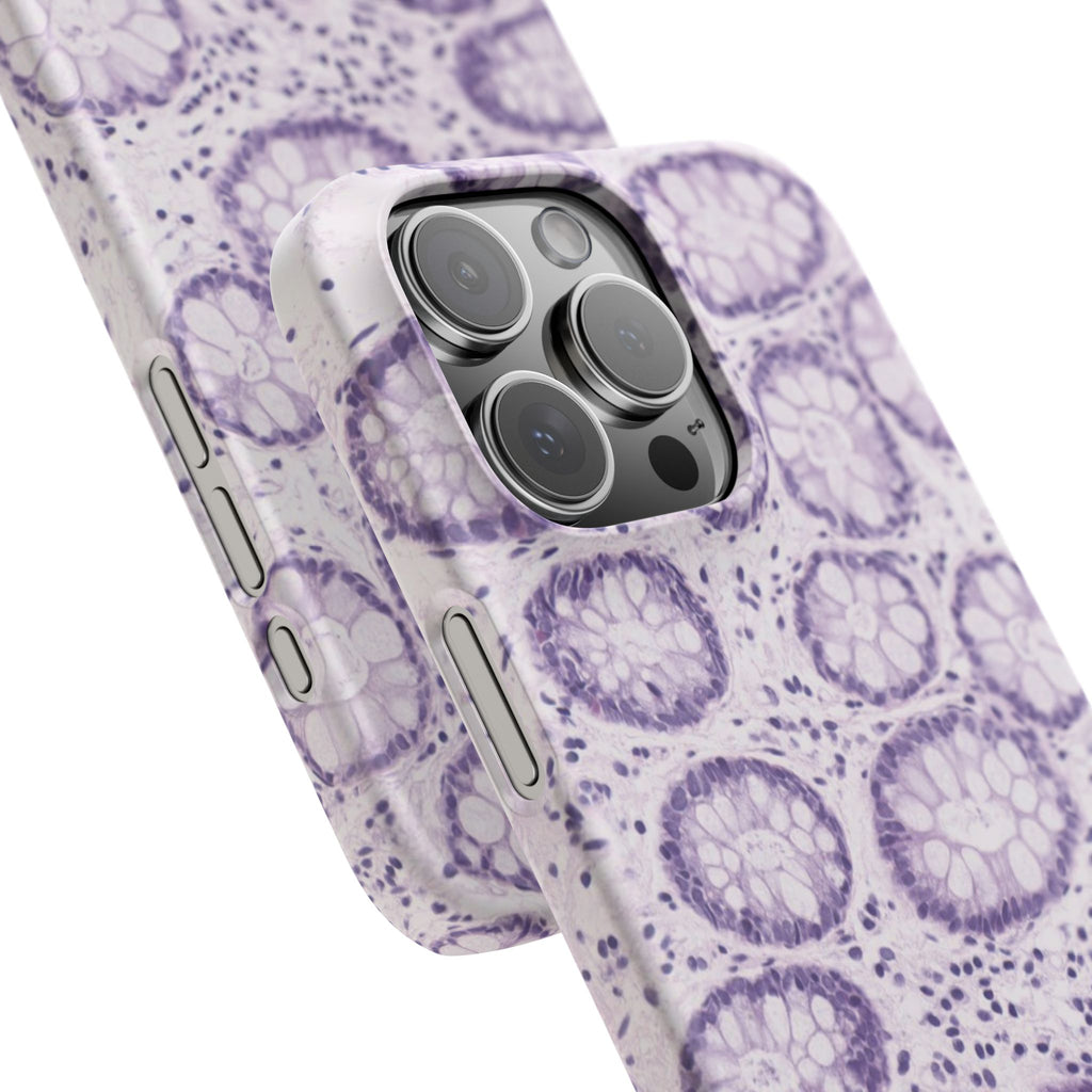 Slim Case Kolon