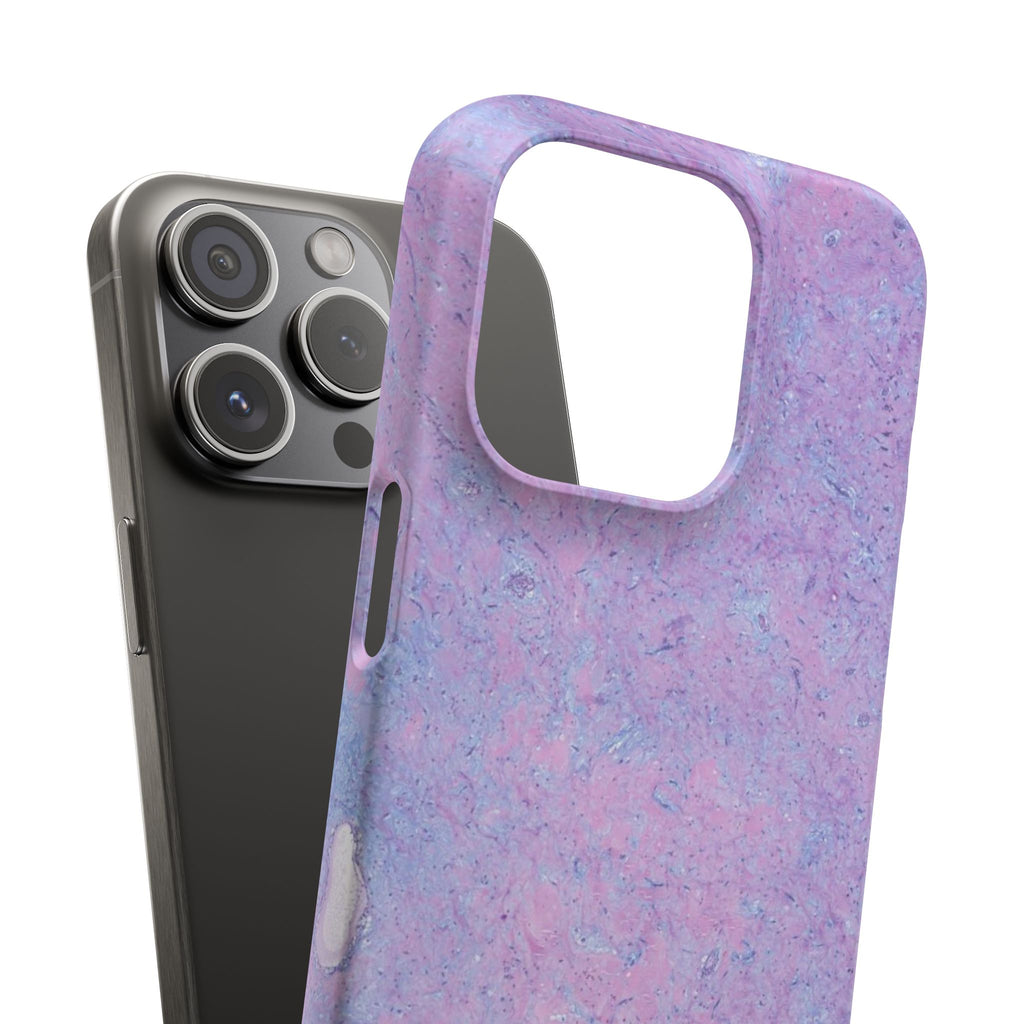 Slim Case Arterielles Myxom