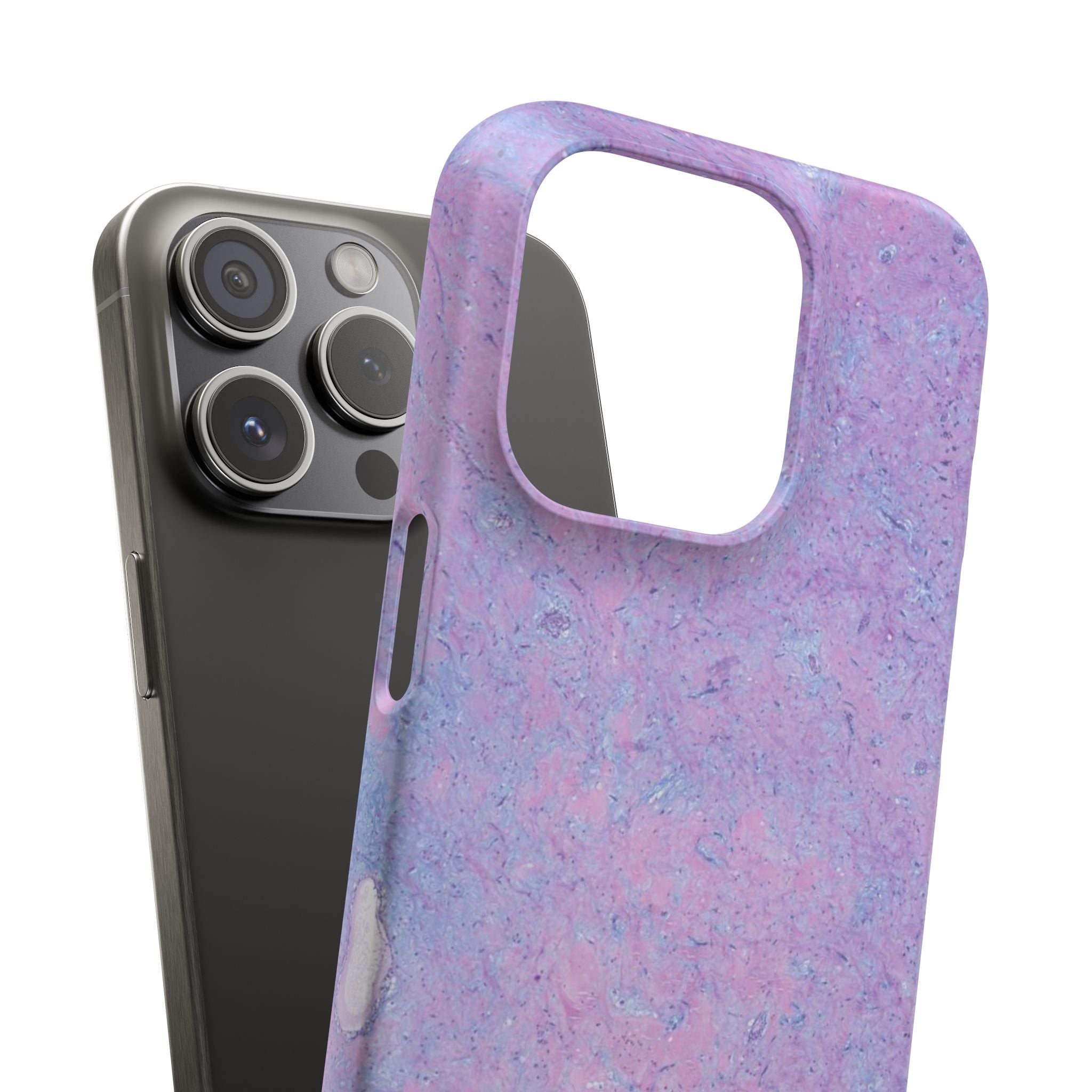 Slim Case Arterielles Myxom