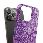 Slim Case Peutz-Jeghers Polyp