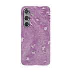 Slim Case Endometrium