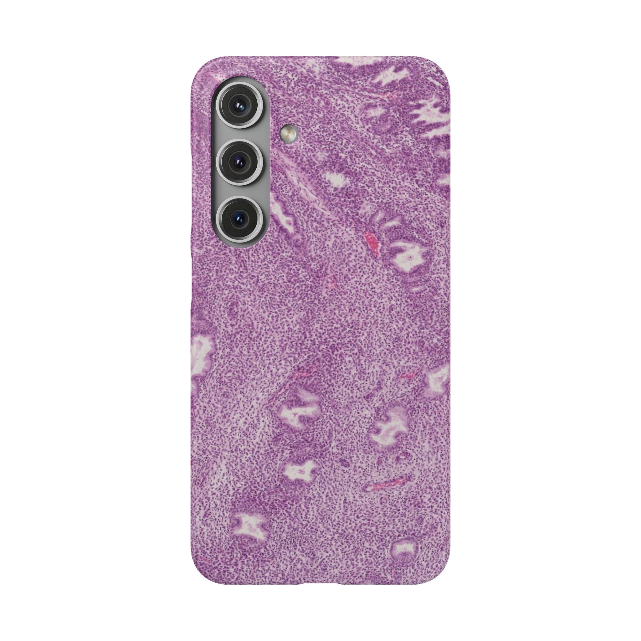 Slim Case Endometrium
