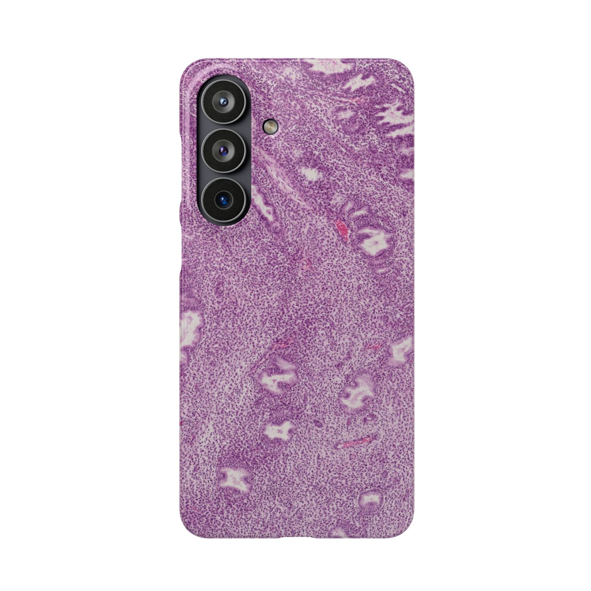 Slim Case Endometrium