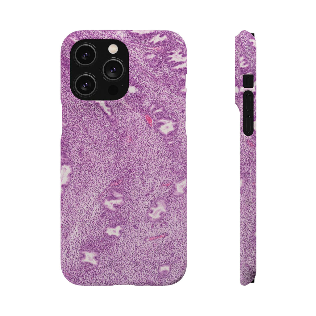 Slim Case Endometrium