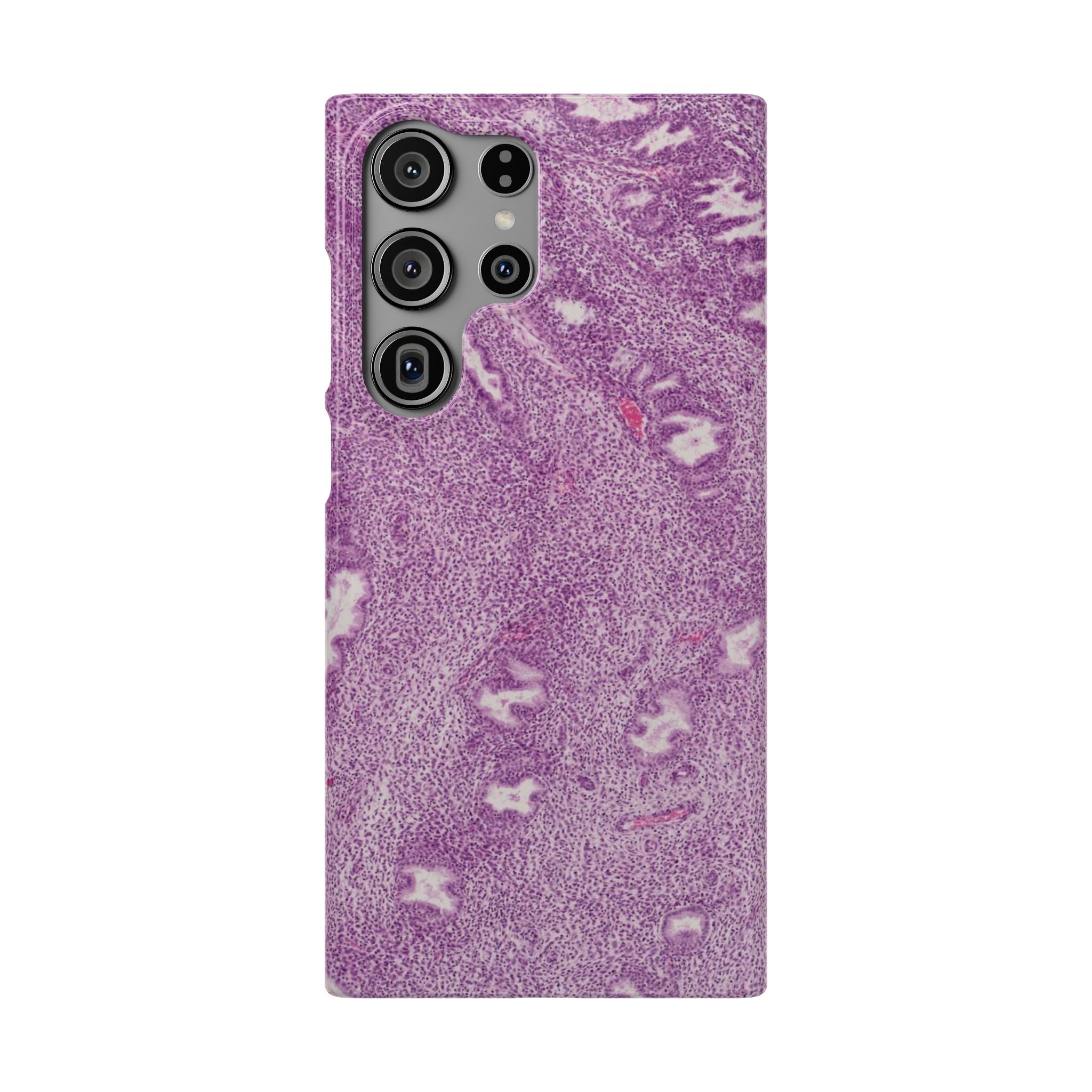 Slim Case Endometrium
