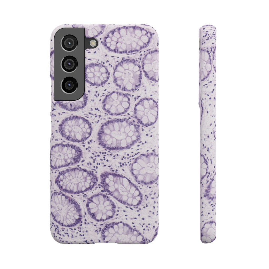 Slim Case Kolon