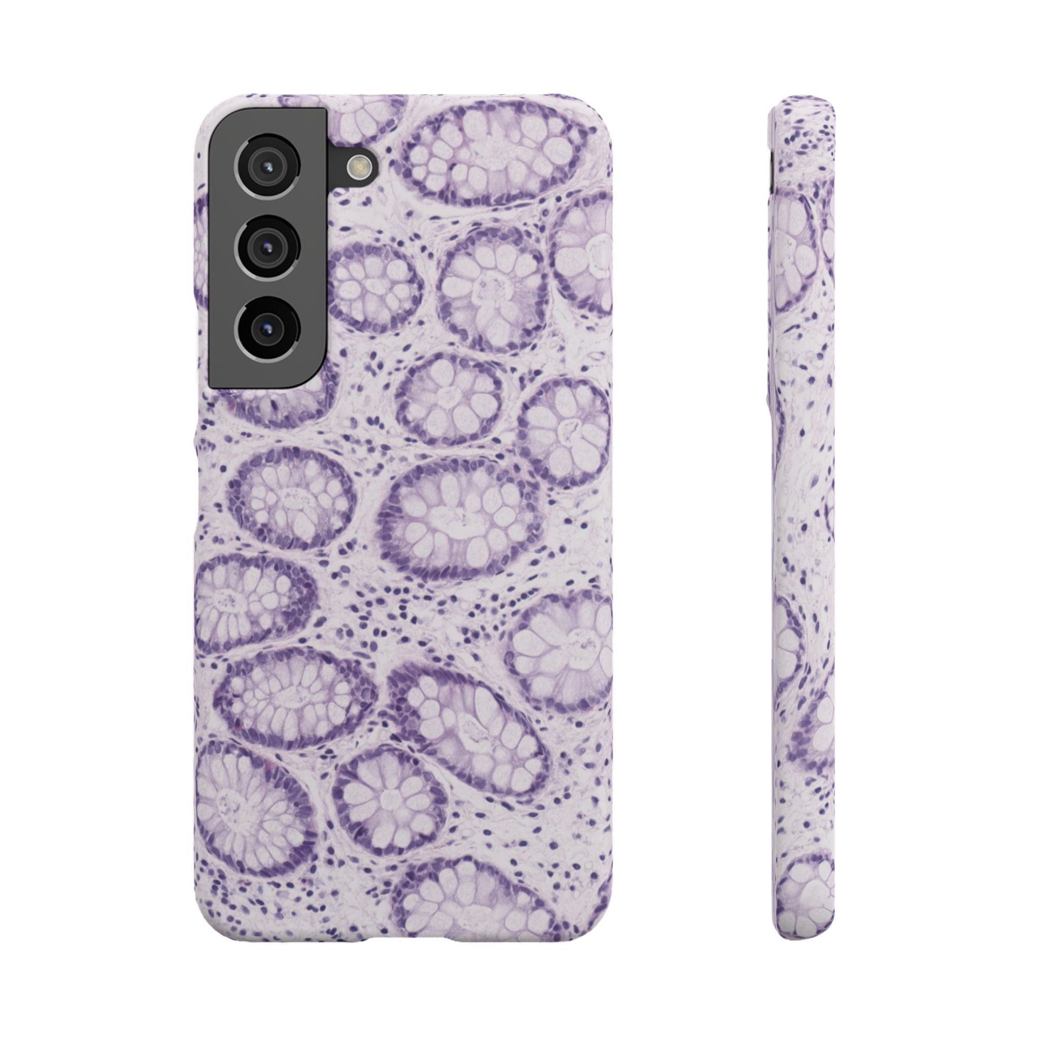 Slim Case Kolon